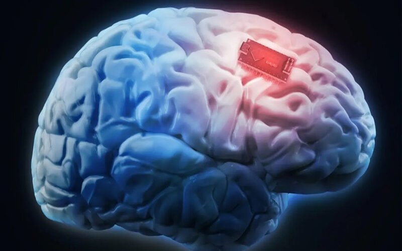 Η αναζήτηση για ενέσιμα εμφυτεύματα εγκεφάλου έχει ξεκινήσει